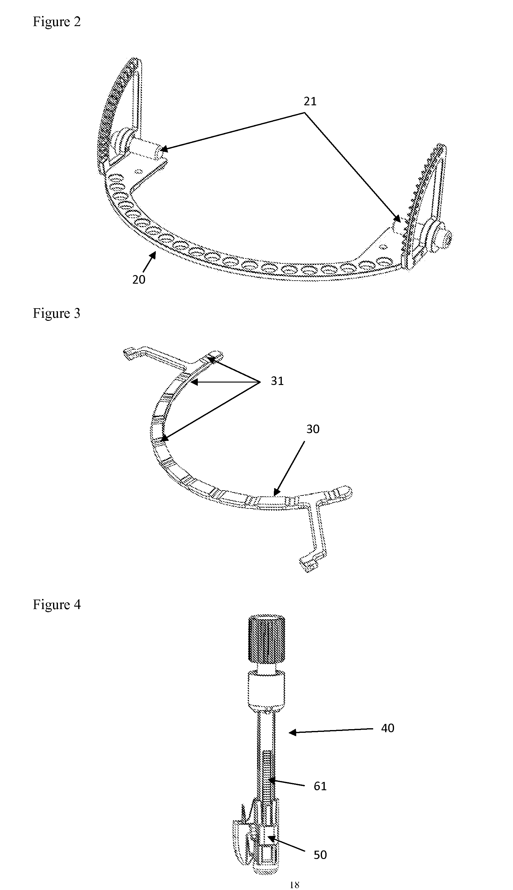 System for reshaping skull