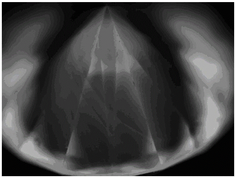 Method and detection device used for distinguishing natural gemstone and synthetic gemstone