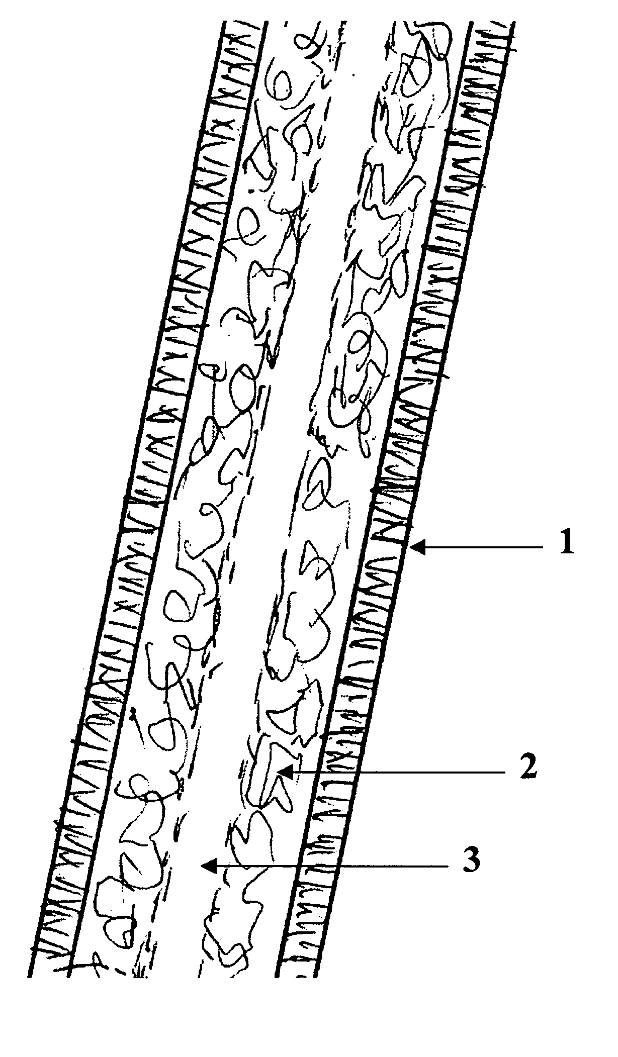 Tissue engineered biomimetic hair follicle graft