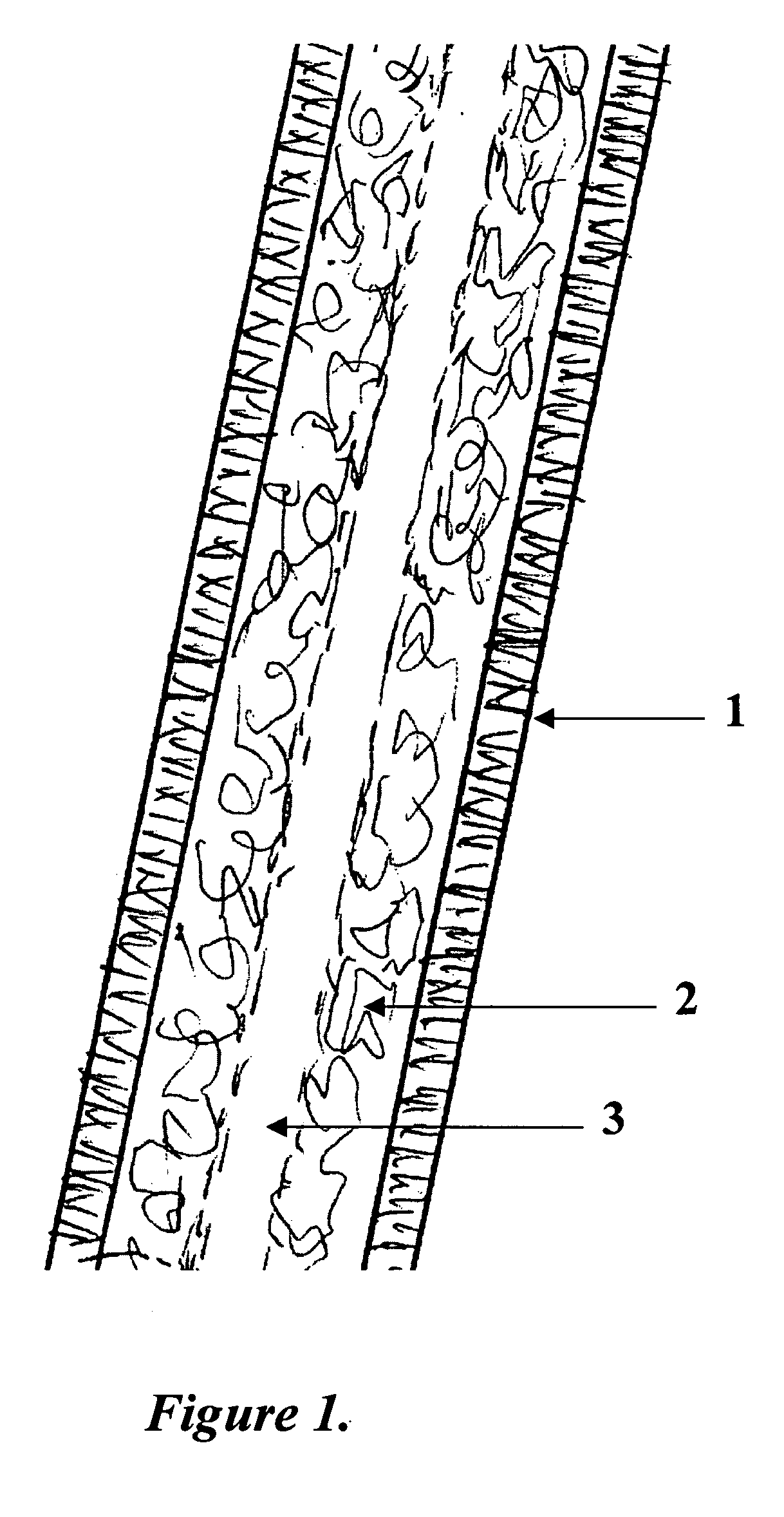 Tissue engineered biomimetic hair follicle graft