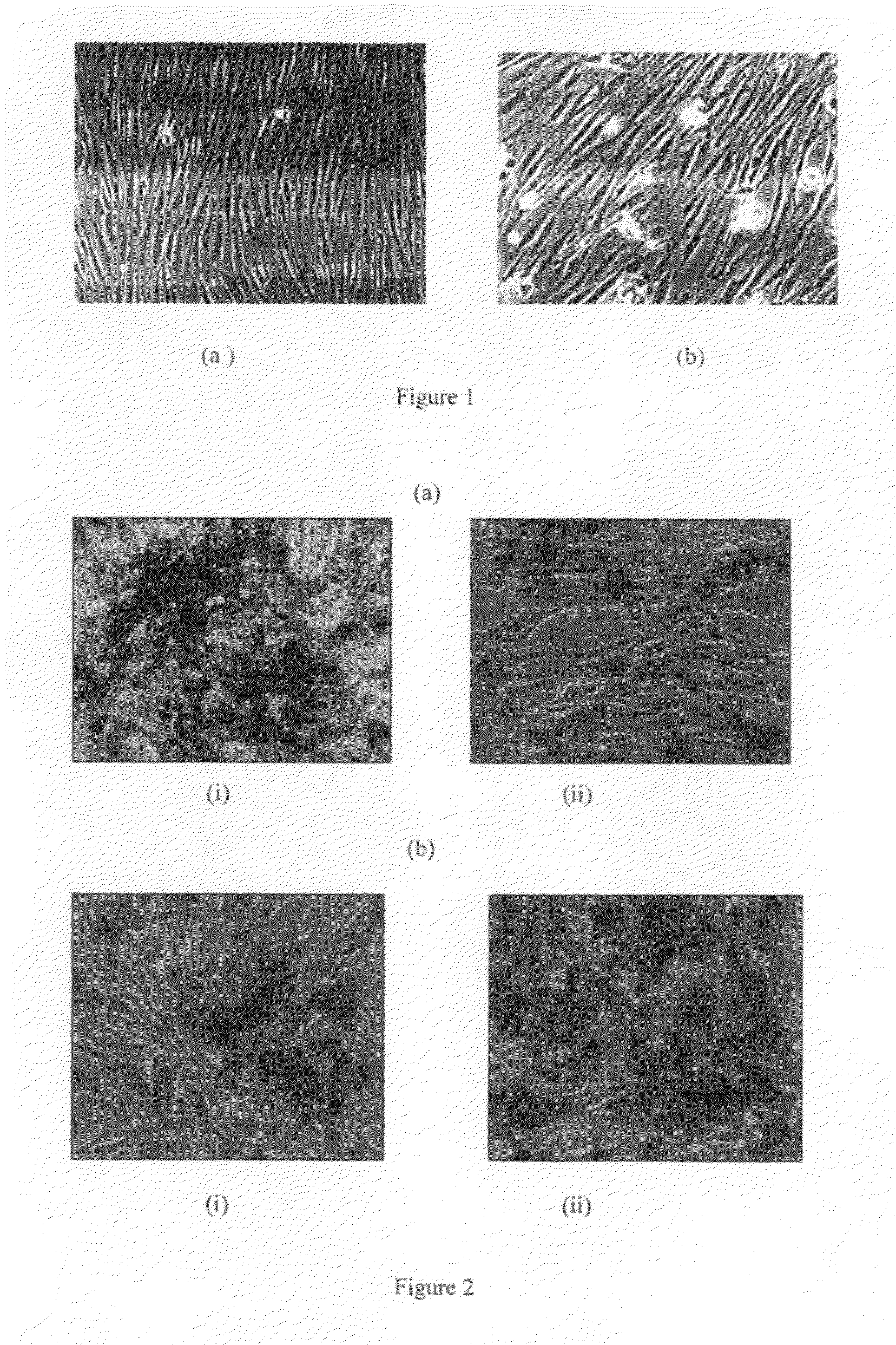 Human Mesenchymal stem cells and preparation thereof