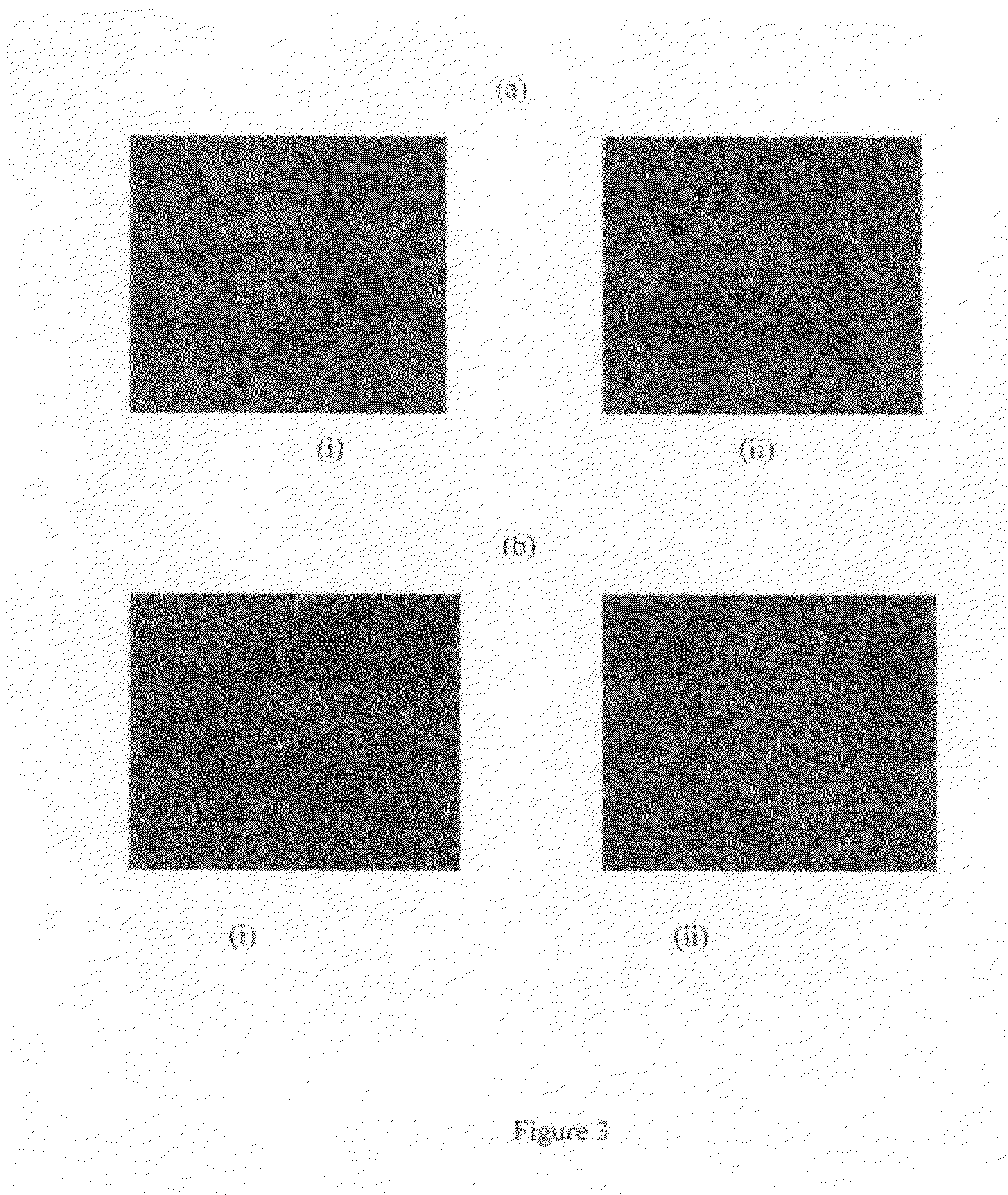 Human Mesenchymal stem cells and preparation thereof