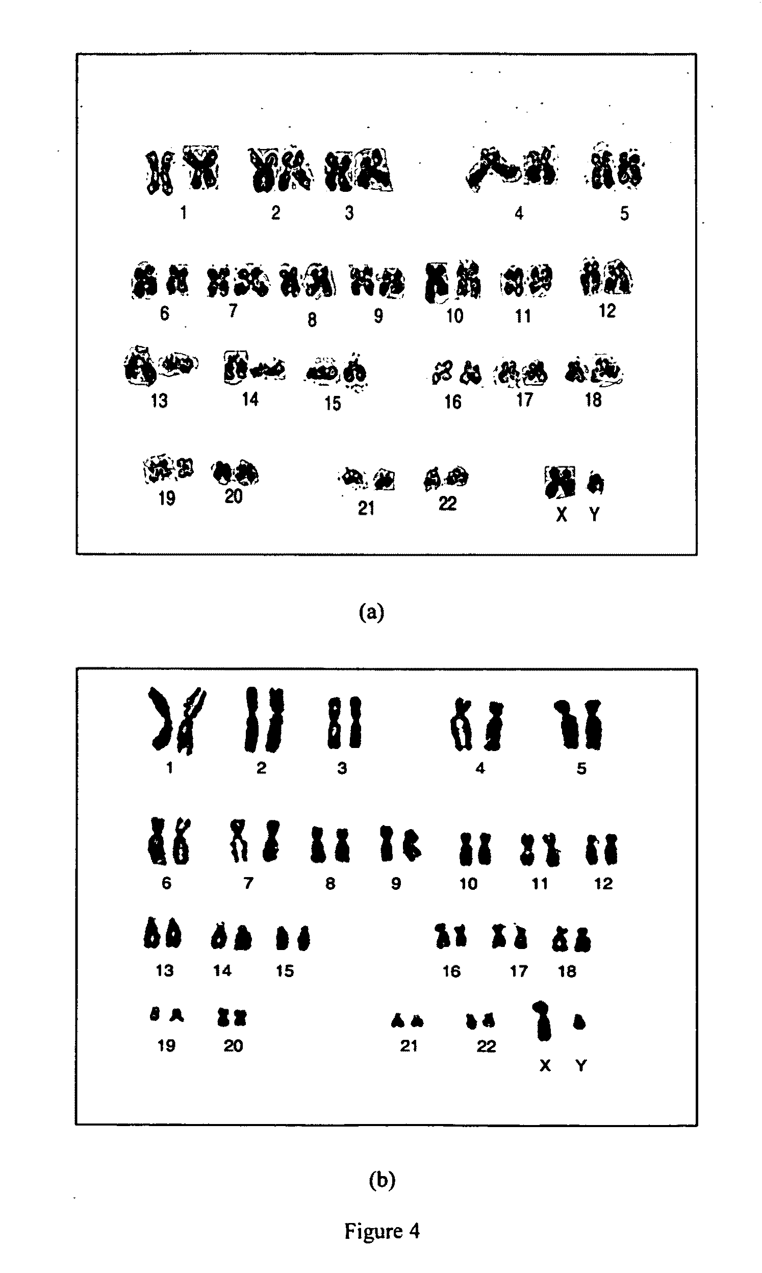 Human Mesenchymal stem cells and preparation thereof