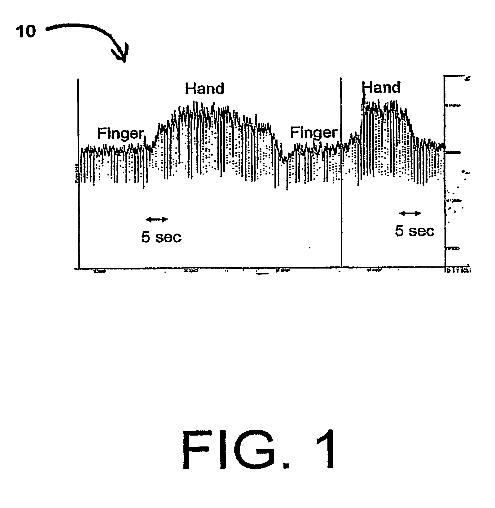 Localization of body lumen junctions