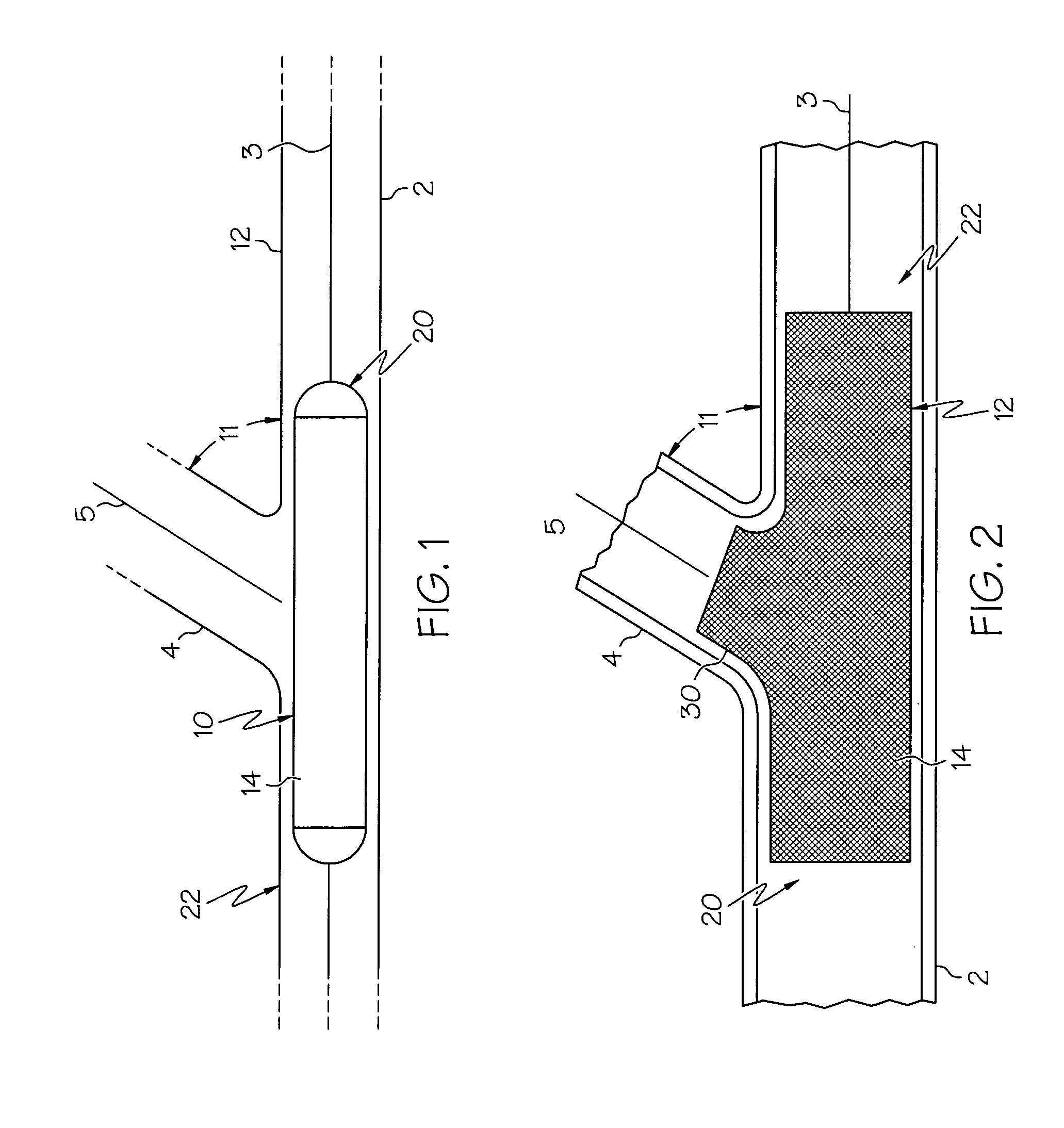 Stent with protruding branch portion for bifurcated vessels