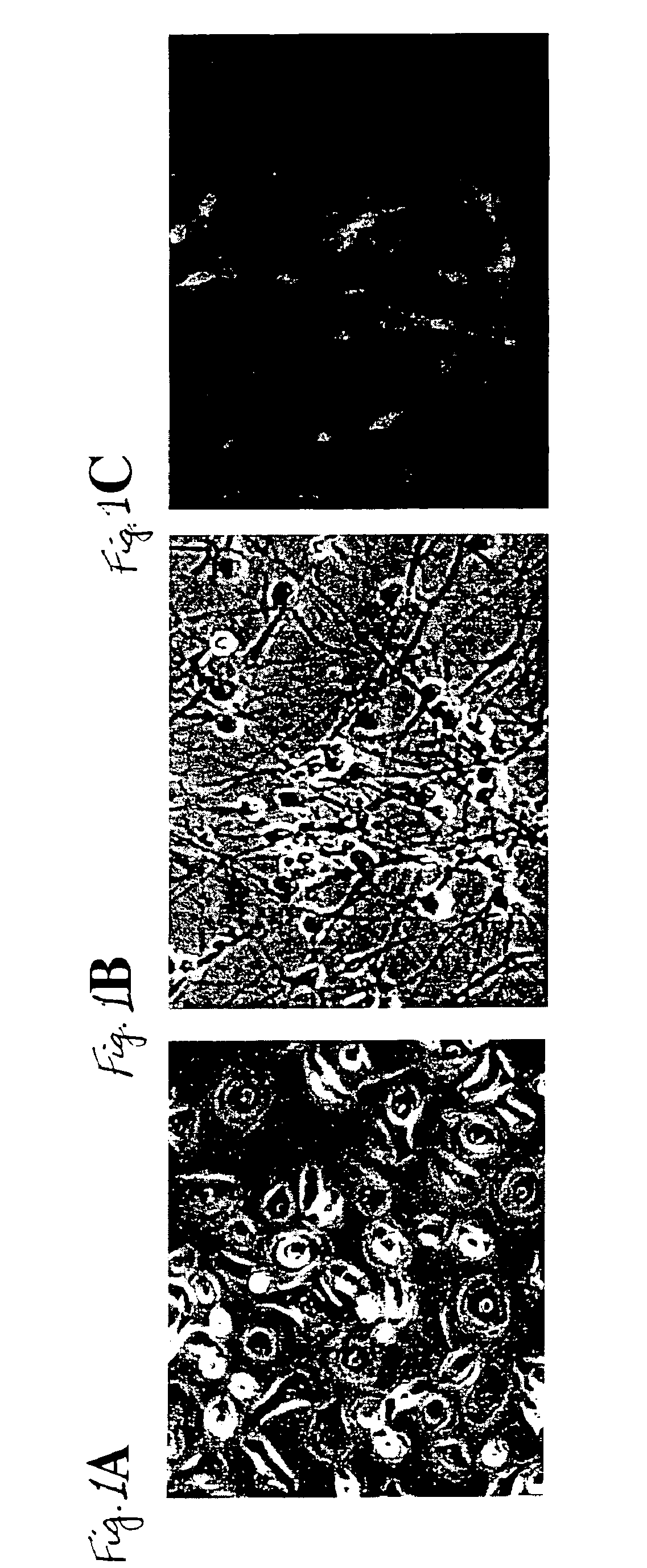 Transdifferentiation of epidermal basal cells into neural progenitor cells, neuronal cells and/or glial cells