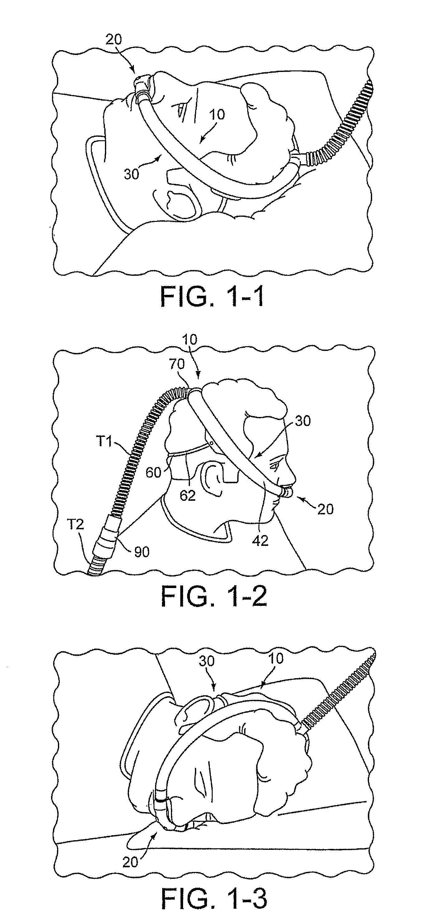 Delivery of Respiratory Therapy