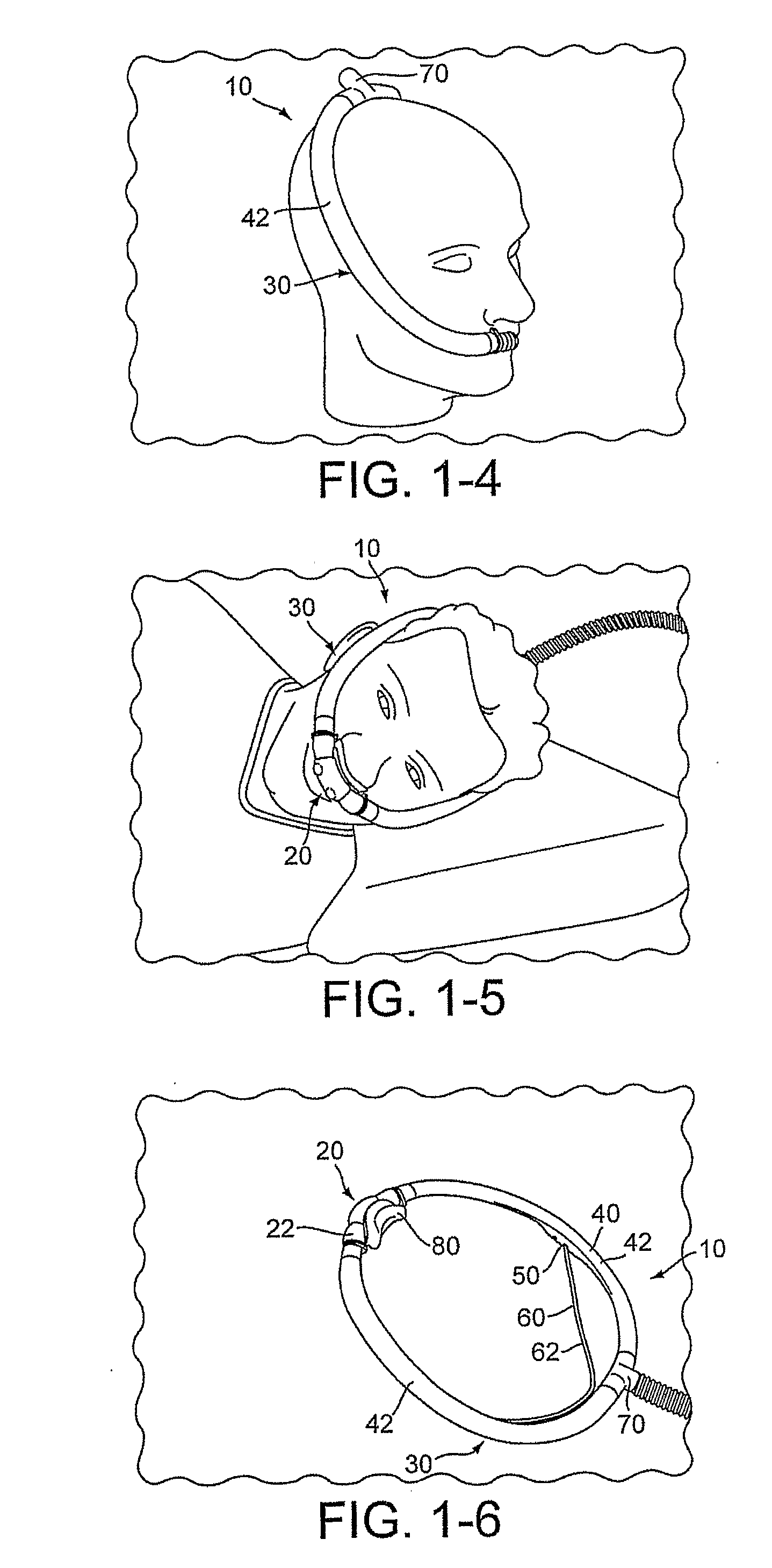 Delivery of Respiratory Therapy