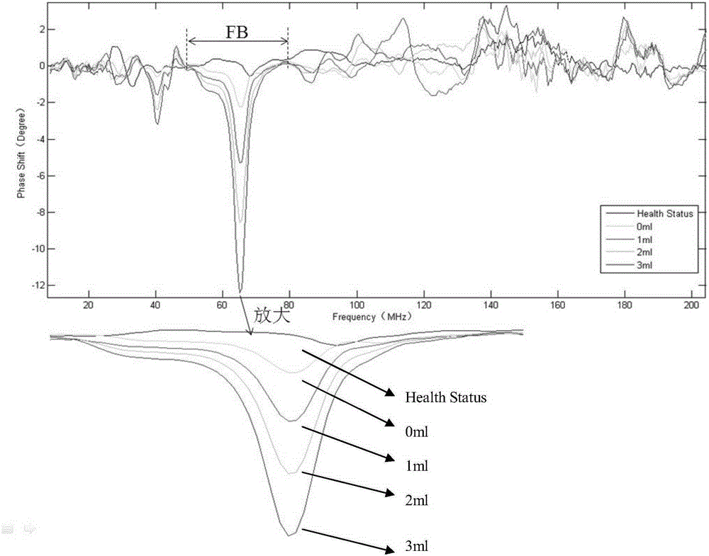 A non-contact magnetic induction cerebral hemorrhage detection device based on characteristic frequency band