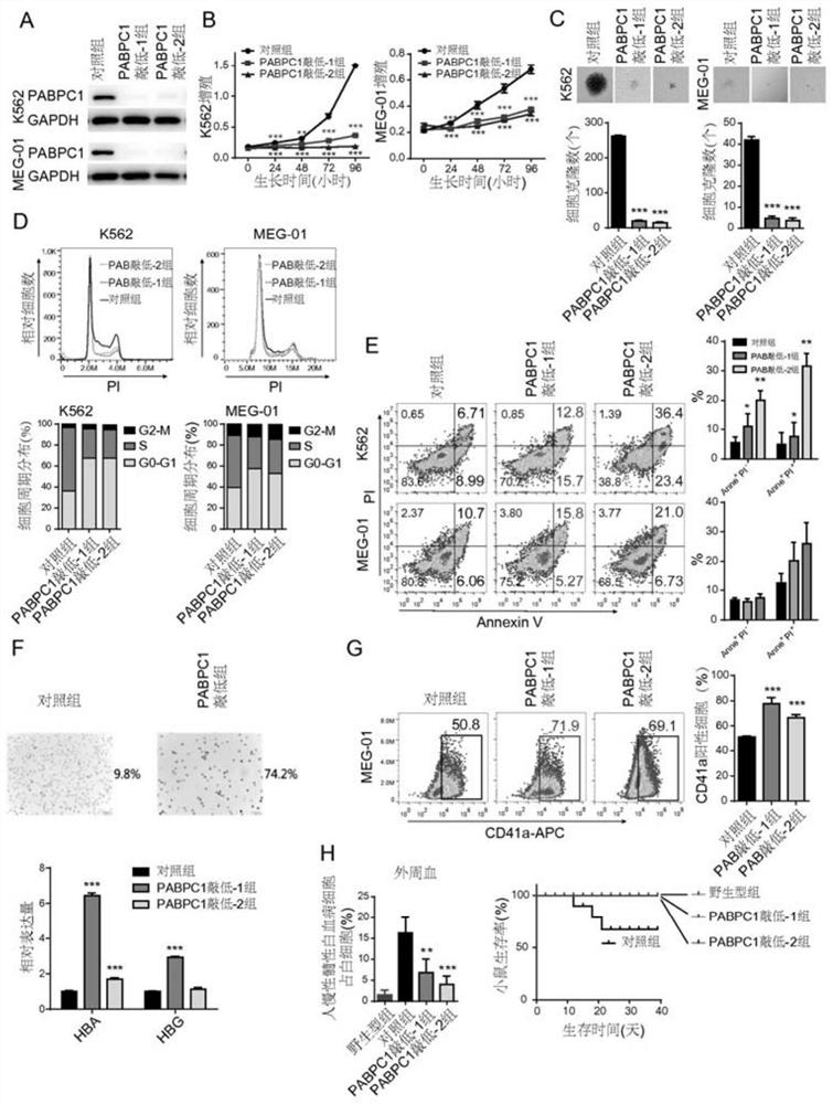 Target PABPC1 related to leukemia diagnosis and treatment and application thereof