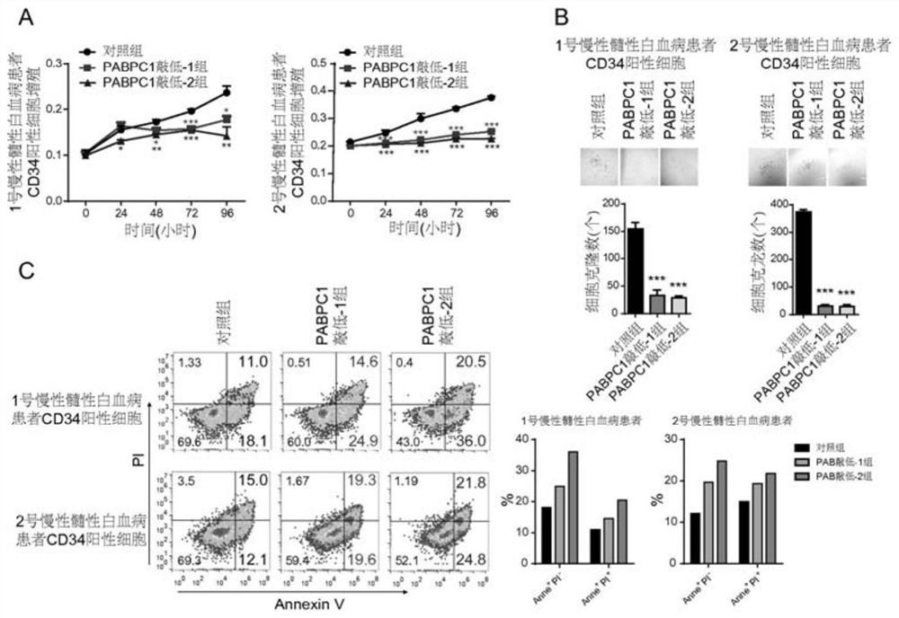 Target PABPC1 related to leukemia diagnosis and treatment and application thereof