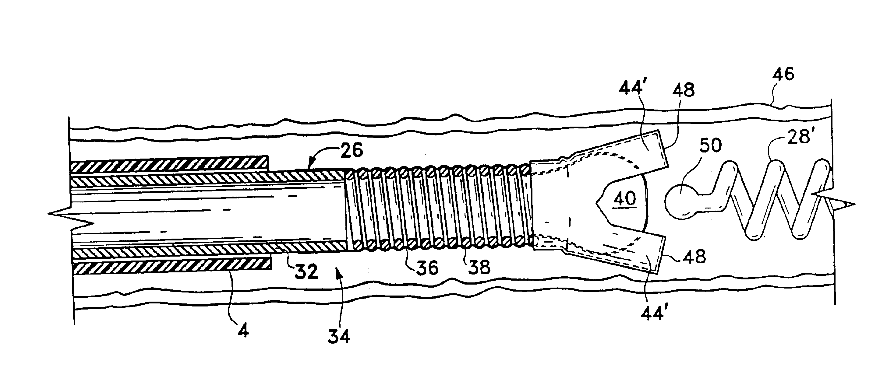 Implant delivery assembly with expandable coupling/decoupling mechanism