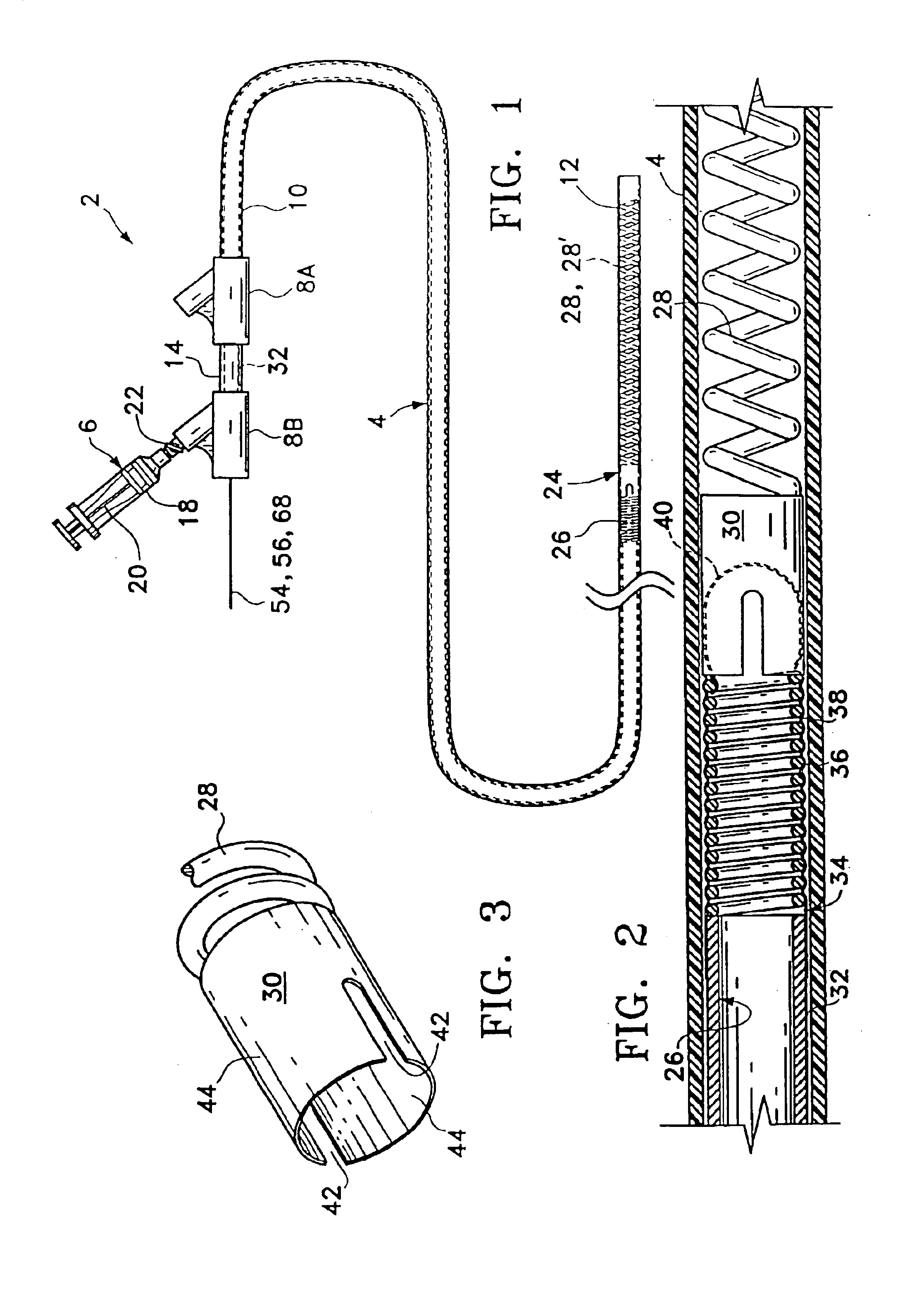 Implant delivery assembly with expandable coupling/decoupling mechanism