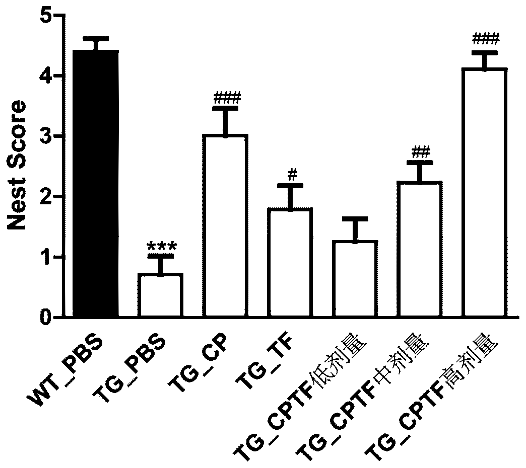 Application of union of covelline albumen and transferrin