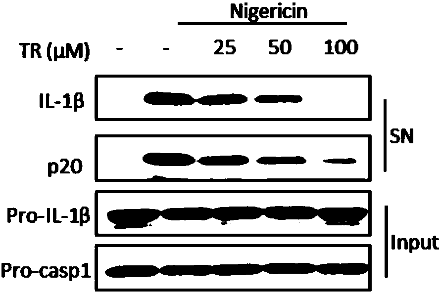 Novel applications of tranilast