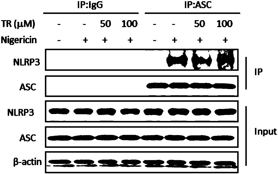 Novel applications of tranilast