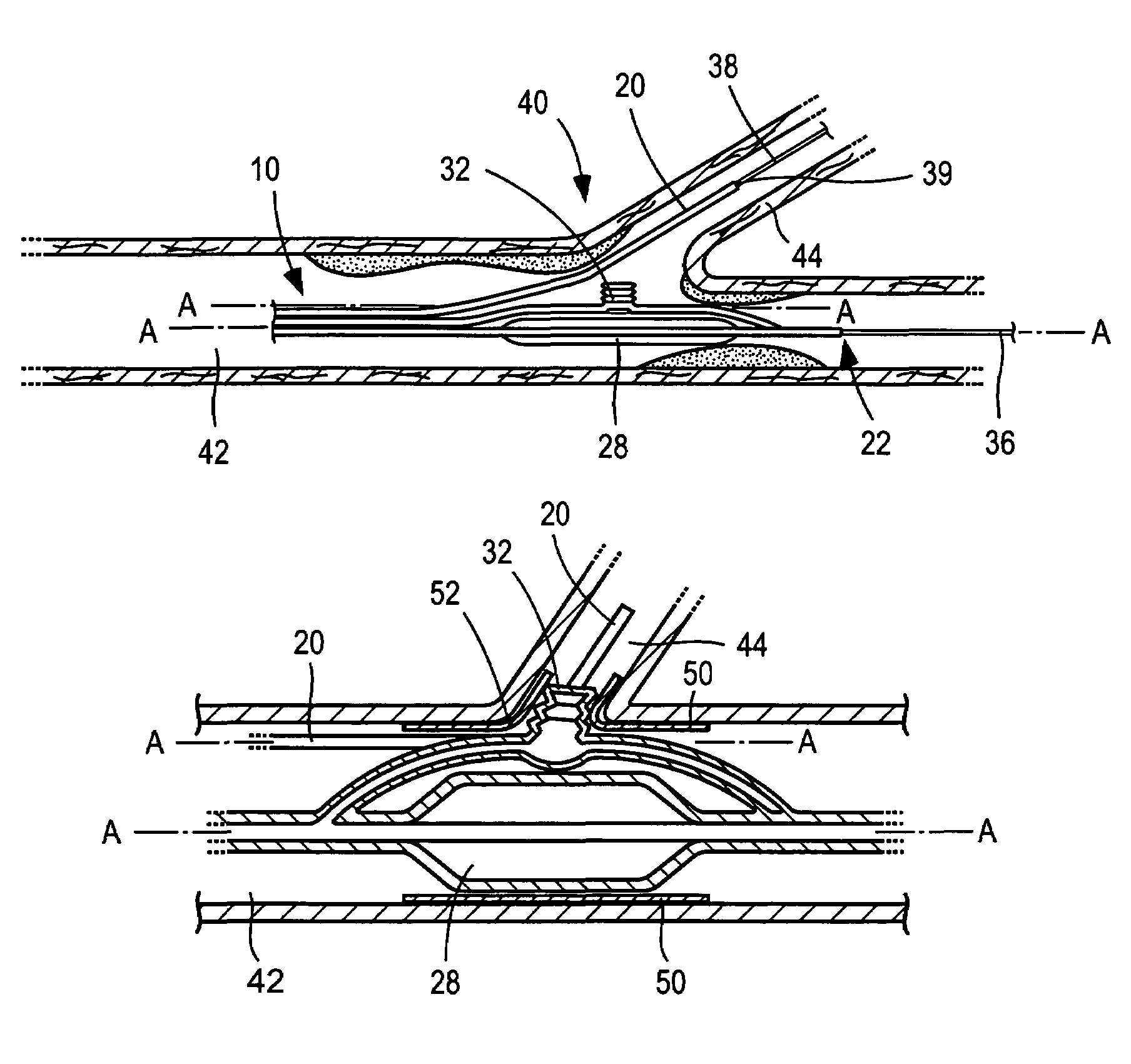 Catheter balloon systems and methods