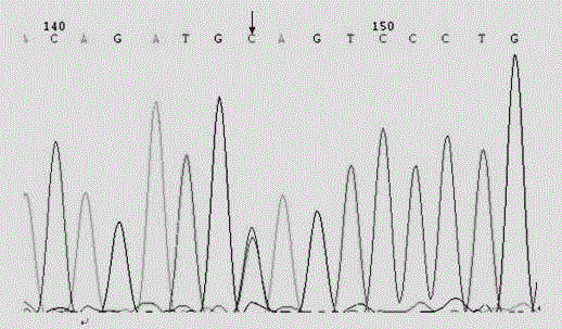 Human CRYBB1 (Crystallin Beta B1) gene mutation and application thereof