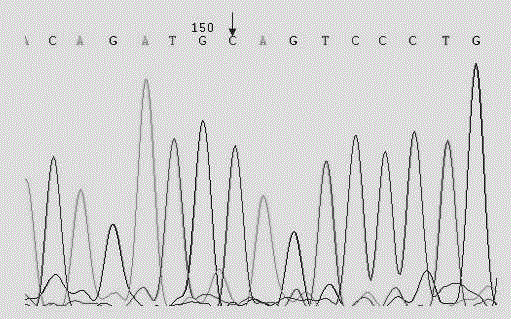 Human CRYBB1 (Crystallin Beta B1) gene mutation and application thereof