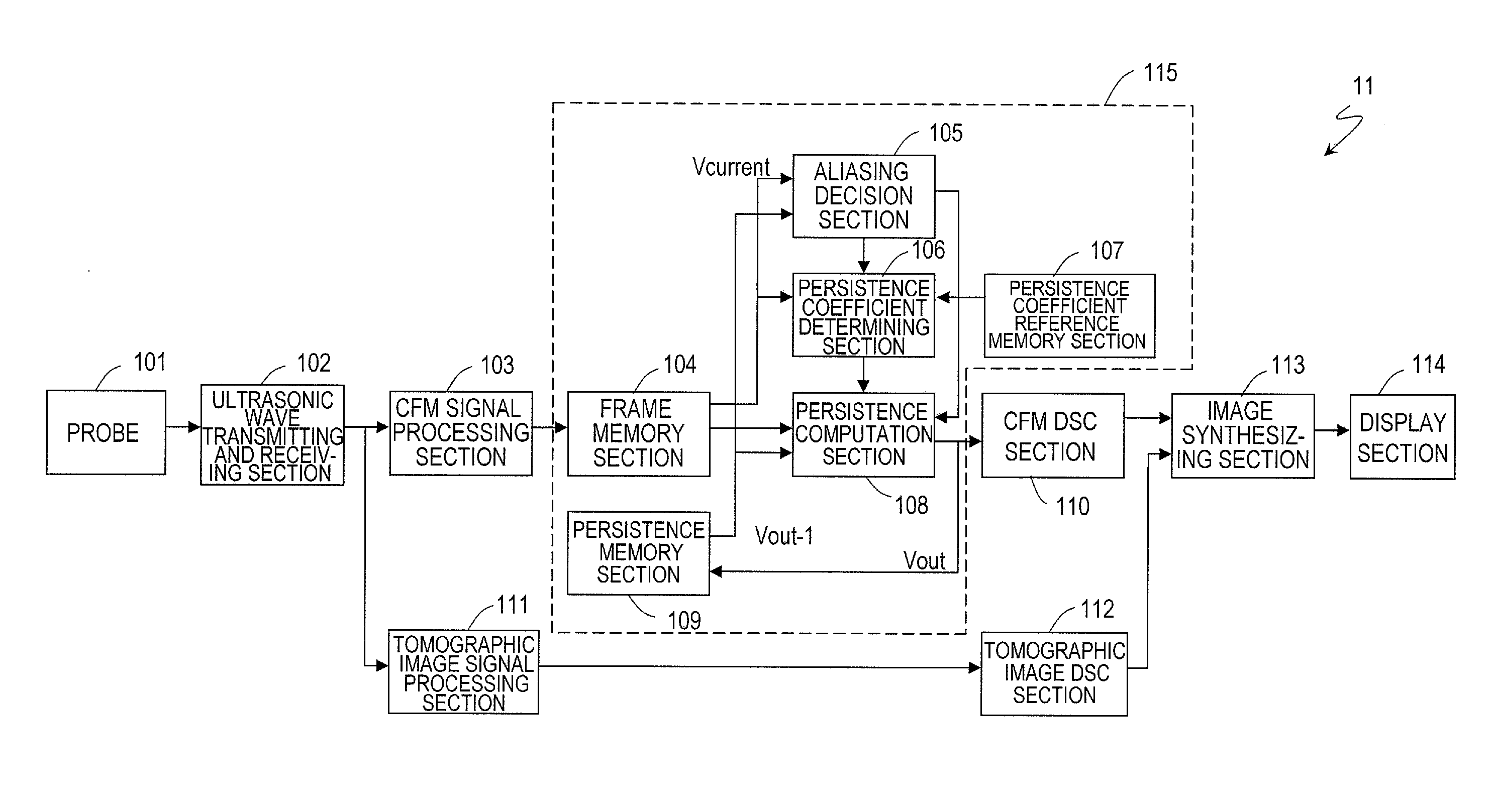 Ultrasonic diagnostic device