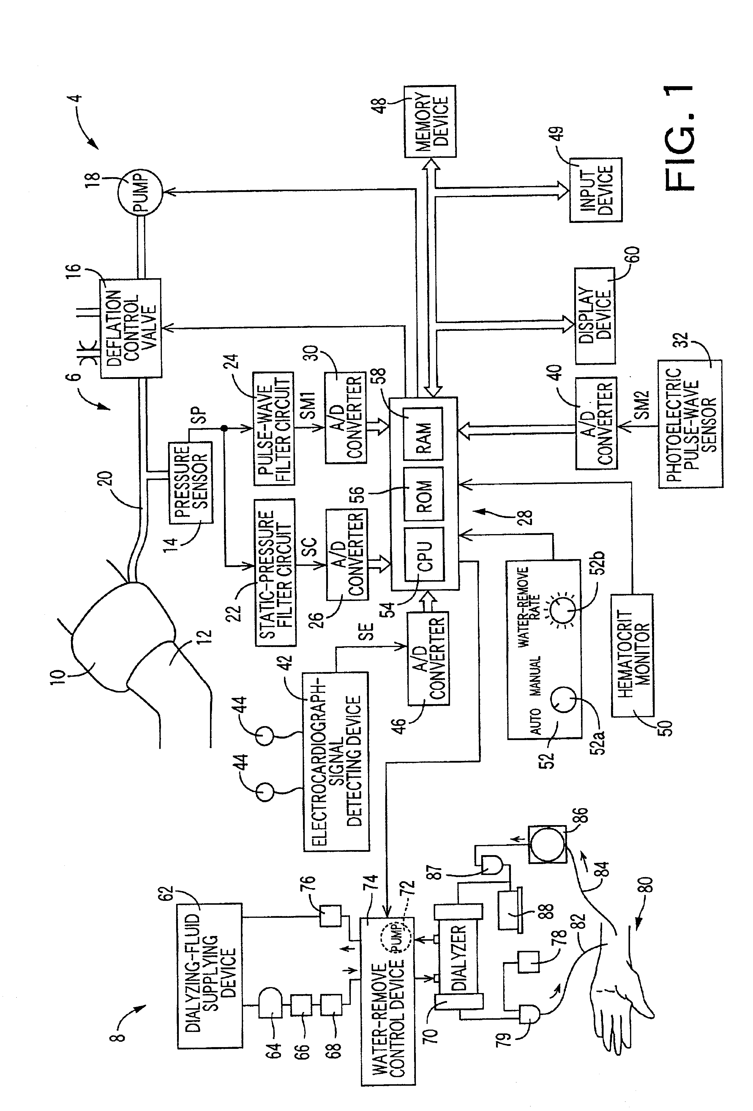 Dialyzing apparatus