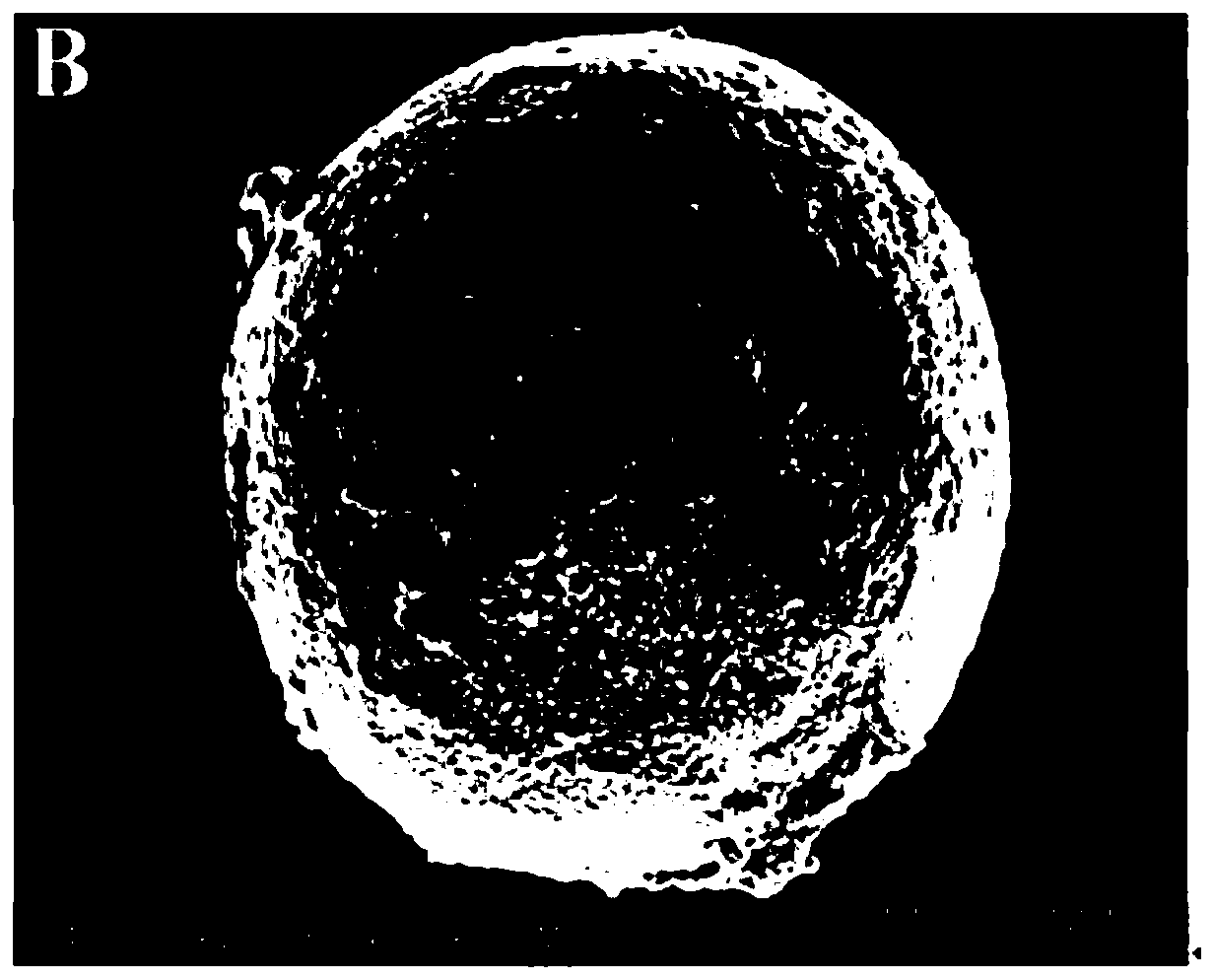 Preparation method of chitosan/sodium tripolyphosphate microsphere slow-release system with embedded GDNF (glial cell-derived neurotrophic factor)