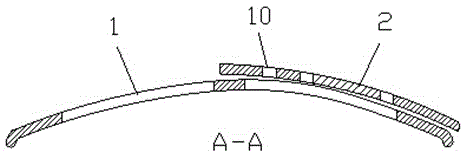 Low-profile peri-locking circular patellar setting fixator