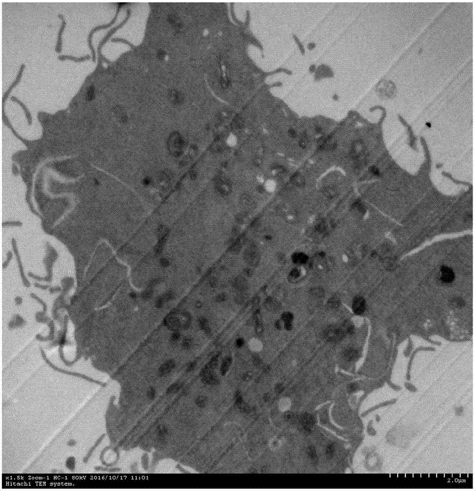 Human pituitary adenoma cell strain and purpose thereof