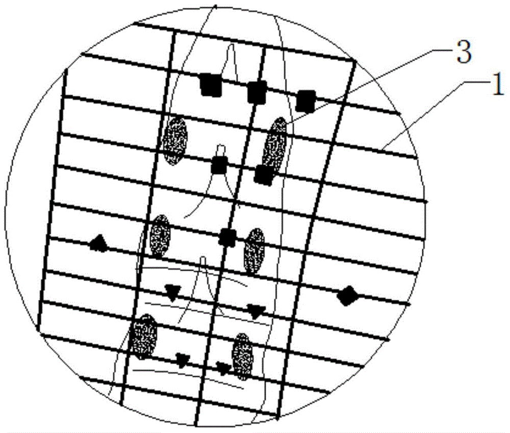 Kit for thoracolumbar vertebral pedicle operation, and use method thereof