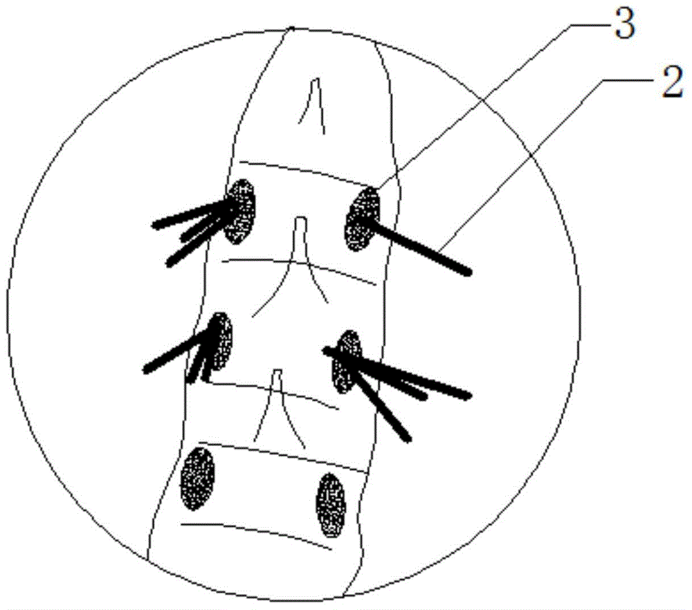 Kit for thoracolumbar vertebral pedicle operation, and use method thereof