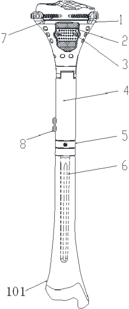 Articular surface retaining type extendable tibial neoplasm knee joint prosthesis