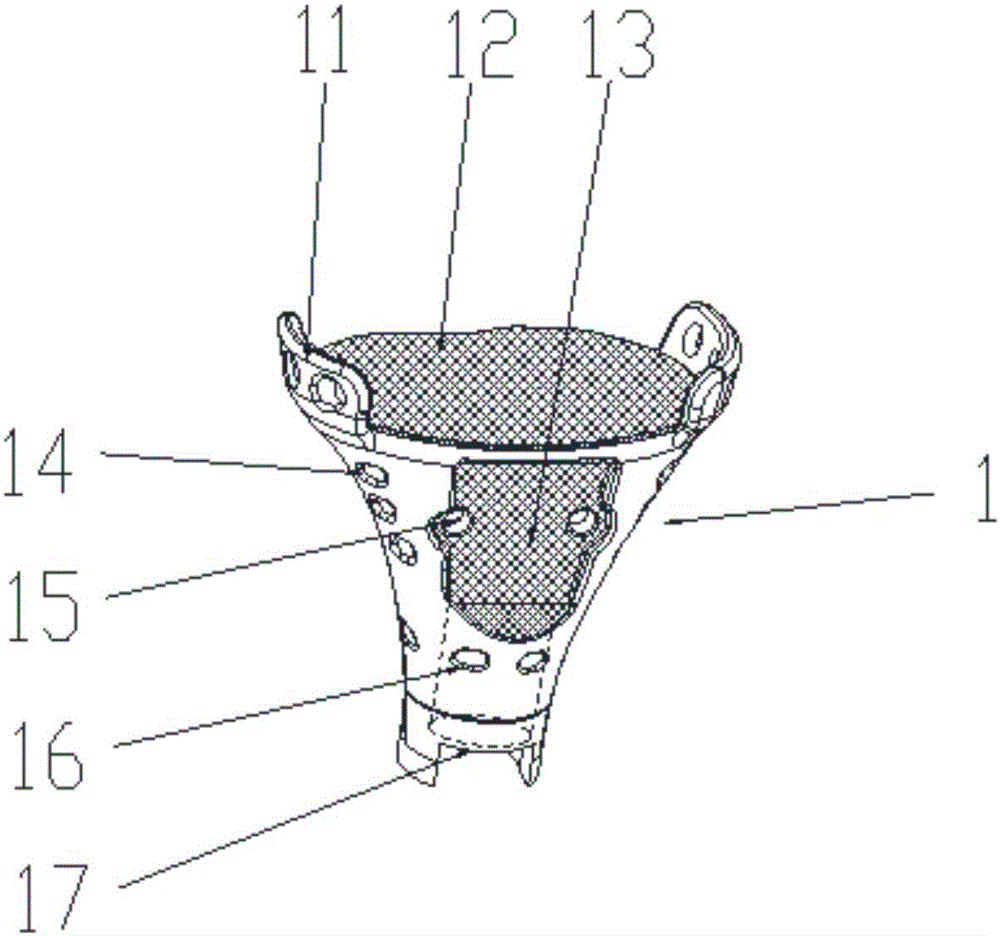 Articular surface retaining type extendable tibial neoplasm knee joint prosthesis