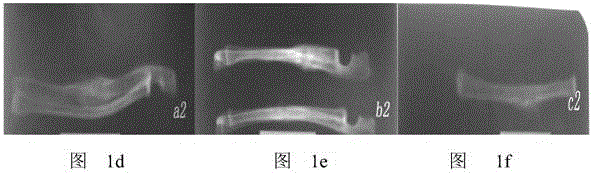 Traditional Chinese medicine composition for harmonizing stomach and setting fracture and preparation method thereof