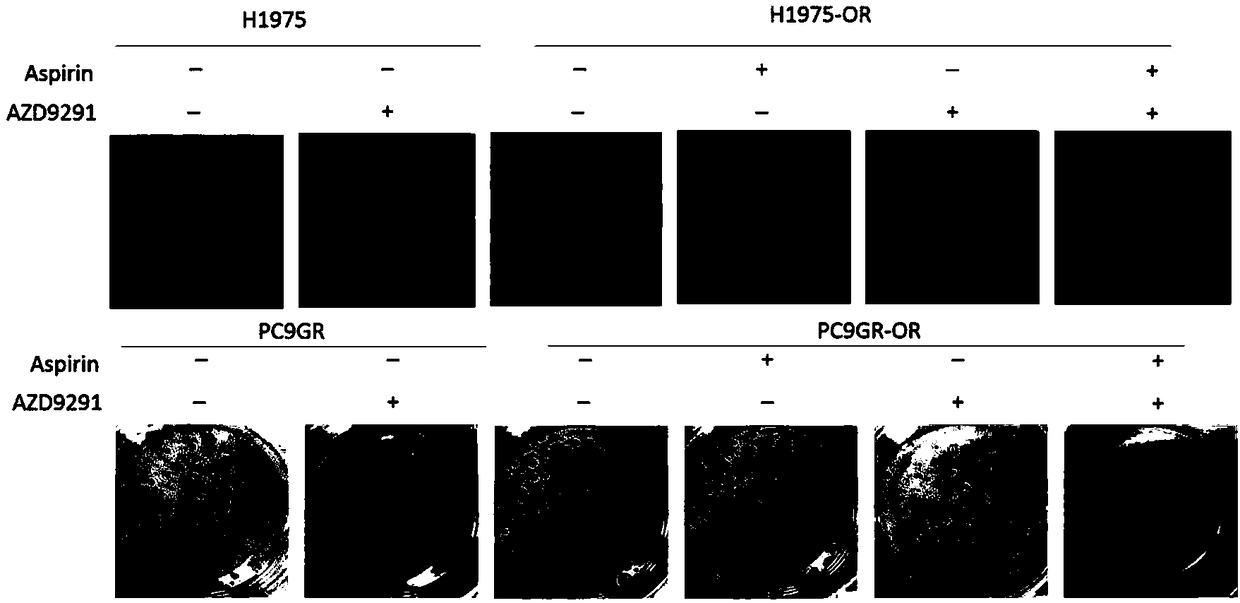 Application of aspirin in preparing medicine for treating NSCLC (non-small cell lung cancer)