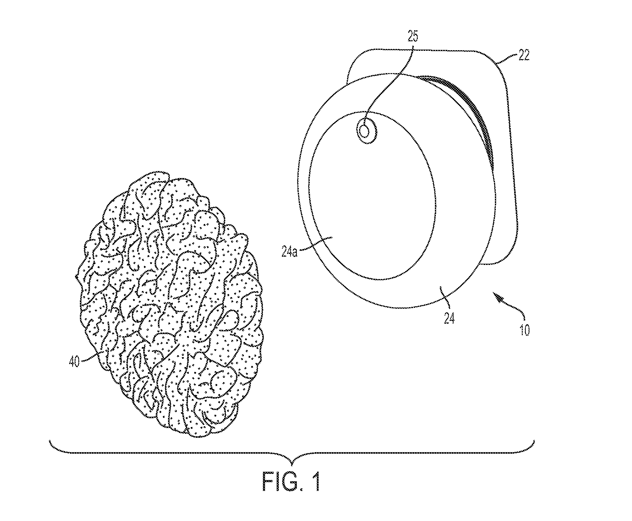 Ostomy appliance