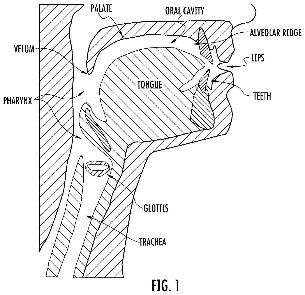 Detecting deep-fake audio through vocal tract reconstruction