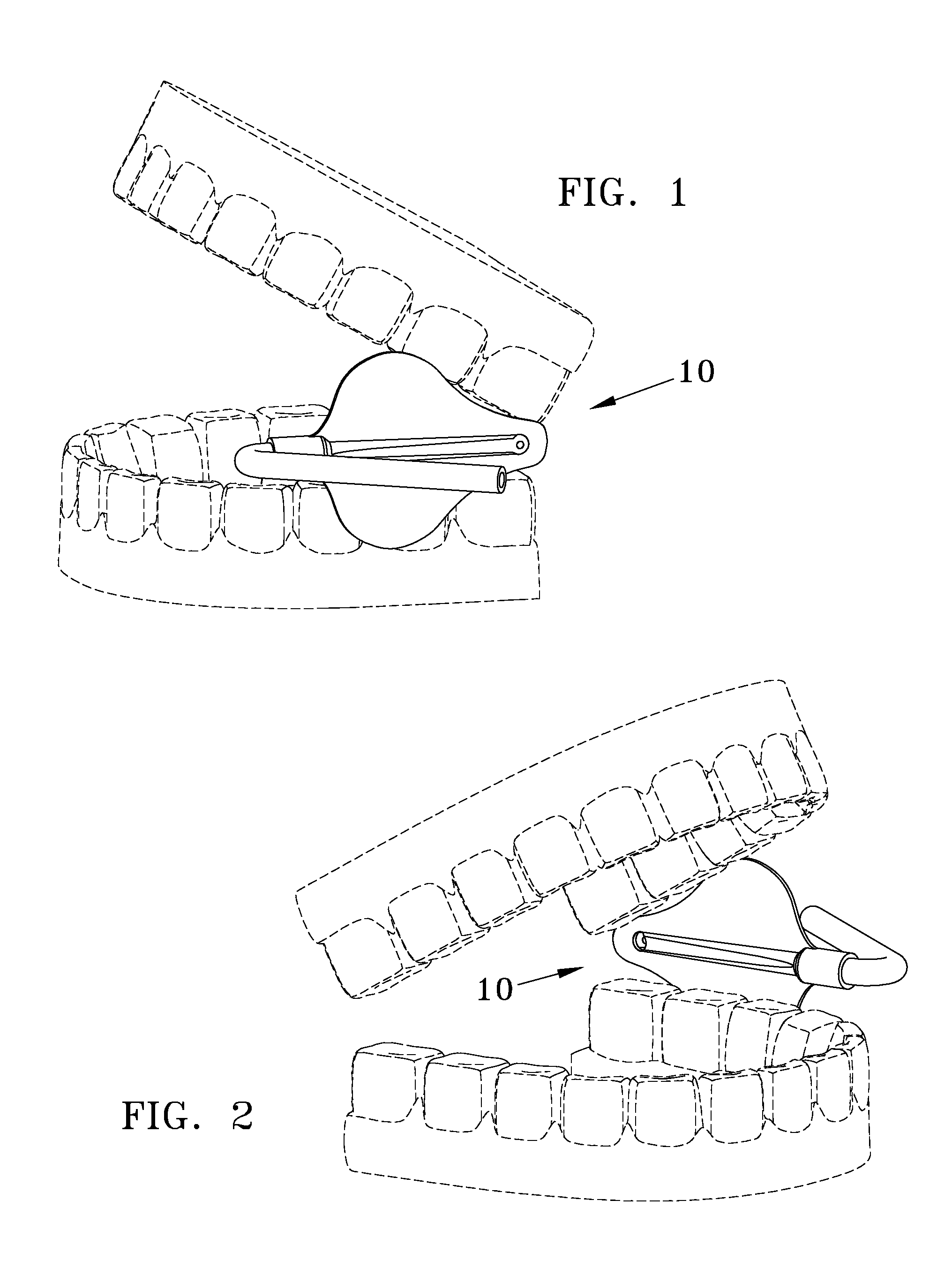 Oral Cavity Suction Device