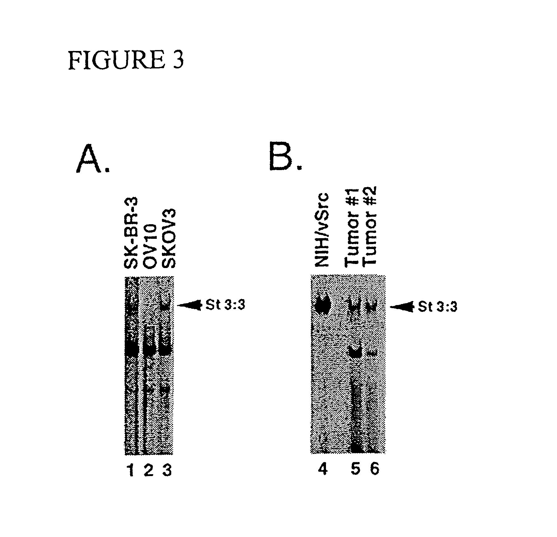 Inhibition of STAT3 signal transduction for human cancer therapy