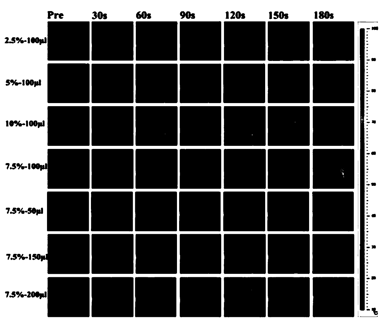 Doxorubicin loaded magnetic PMMA (polymethyl methacrylate) bone cement and preparation method and application thereof