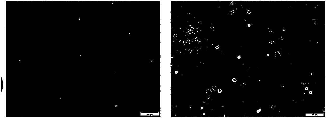 Hertwig's epithelial root sheath cell lines HERS-H1 and HERS-C2 of SD rats as well as establishing method and applications of Hertwig's epithelial root sheath cell lines HERS-H1 and HERS-C2