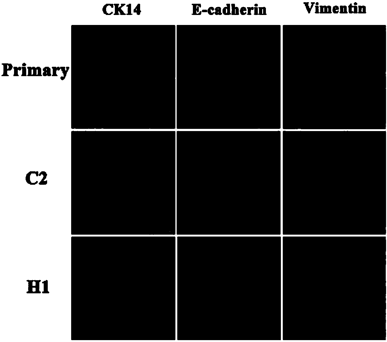 Hertwig's epithelial root sheath cell lines HERS-H1 and HERS-C2 of SD rats as well as establishing method and applications of Hertwig's epithelial root sheath cell lines HERS-H1 and HERS-C2