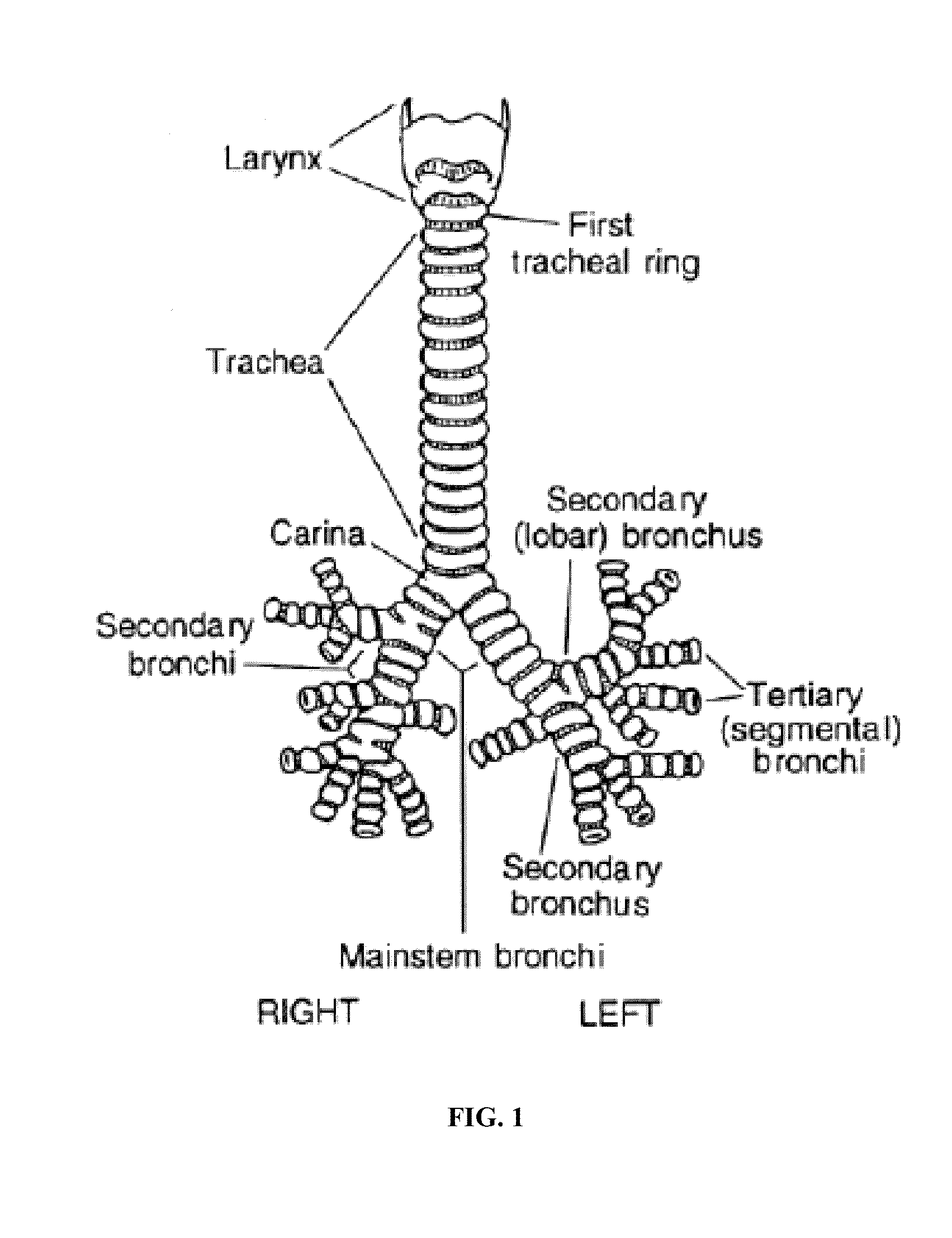 System for manufacturing fiber scaffolds for use in tracheal prostheses