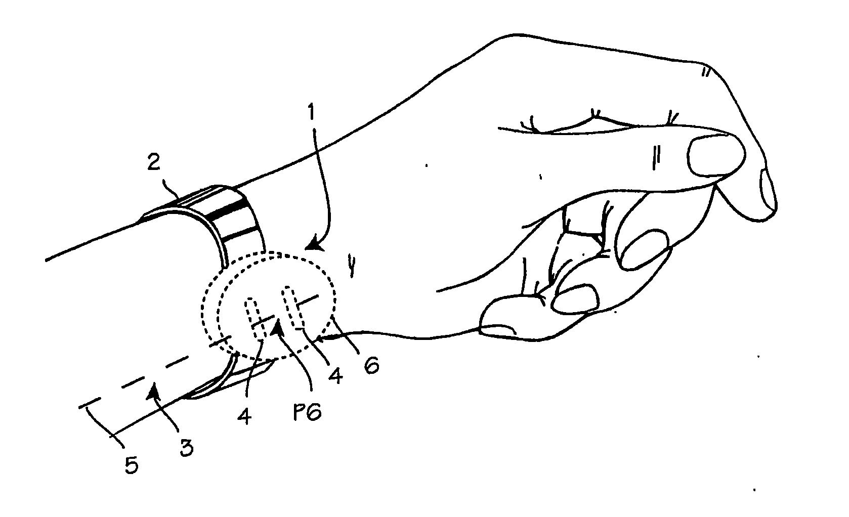 Method of relieving migraines or headaches