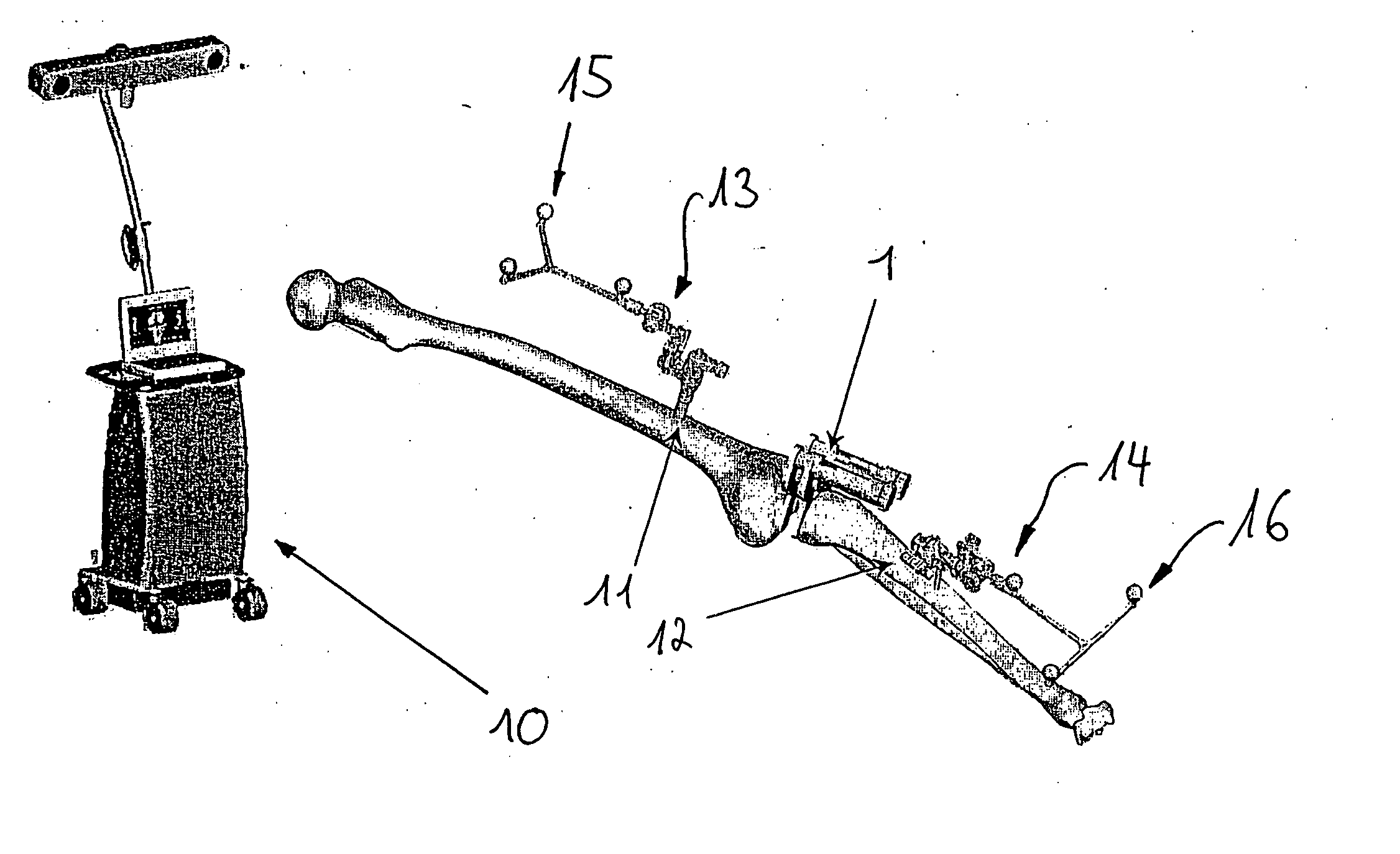 Ligament force detection system