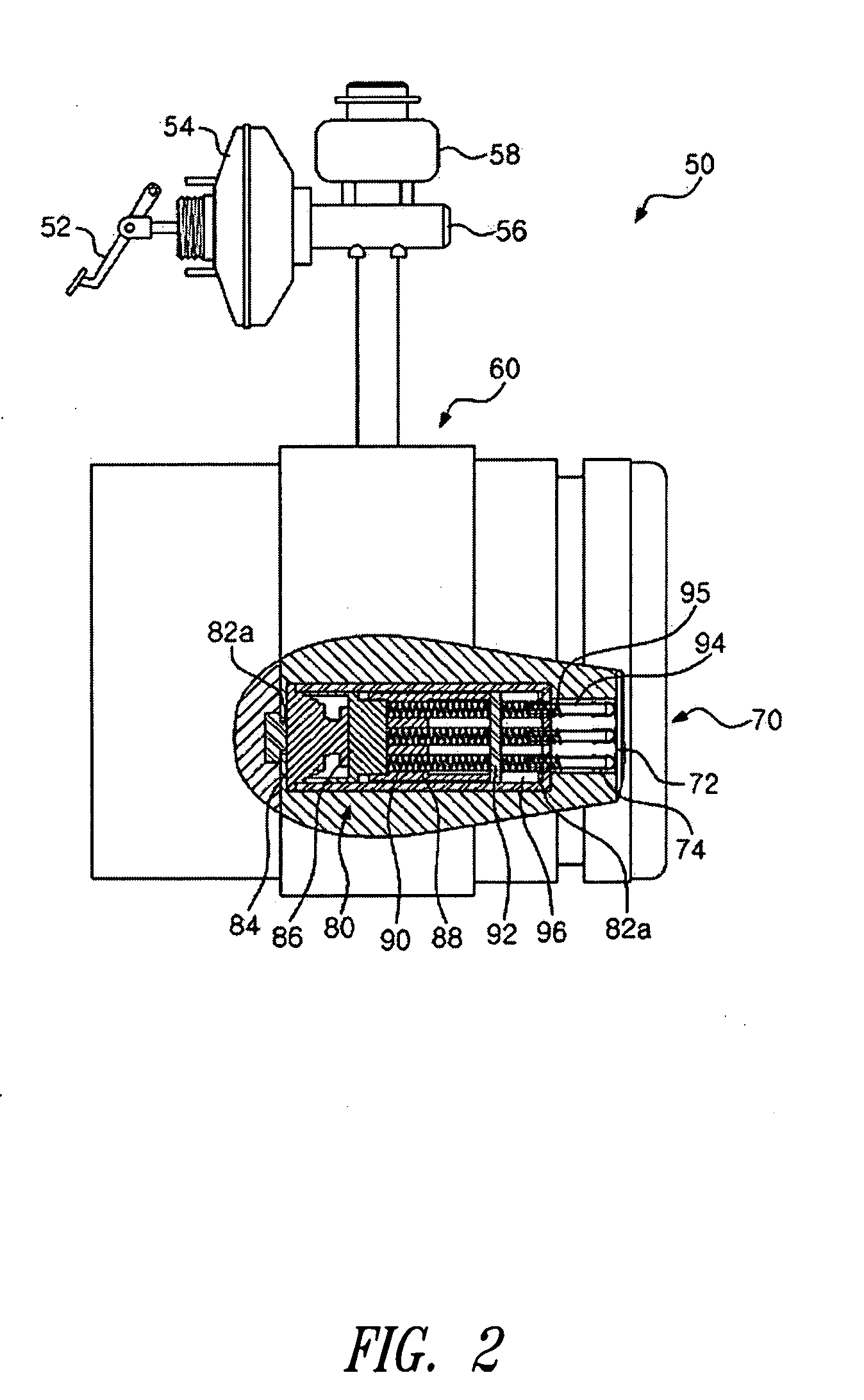 Pressure sensor