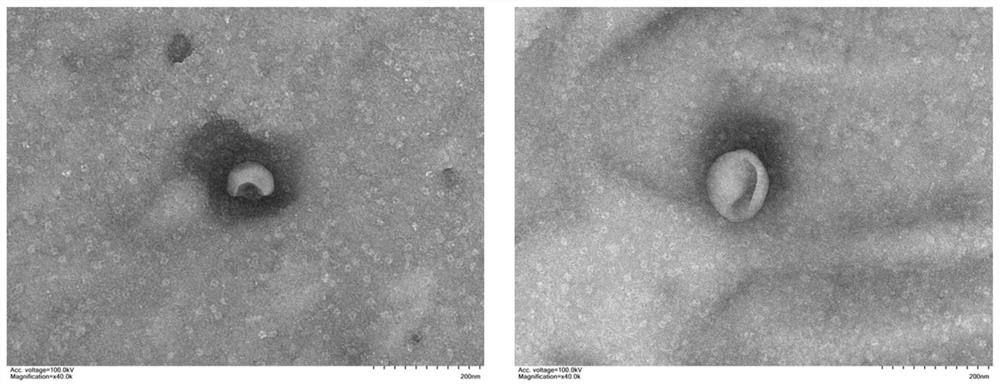 High-expression NAMPT protein-containing exosome and preparation method and application thereof