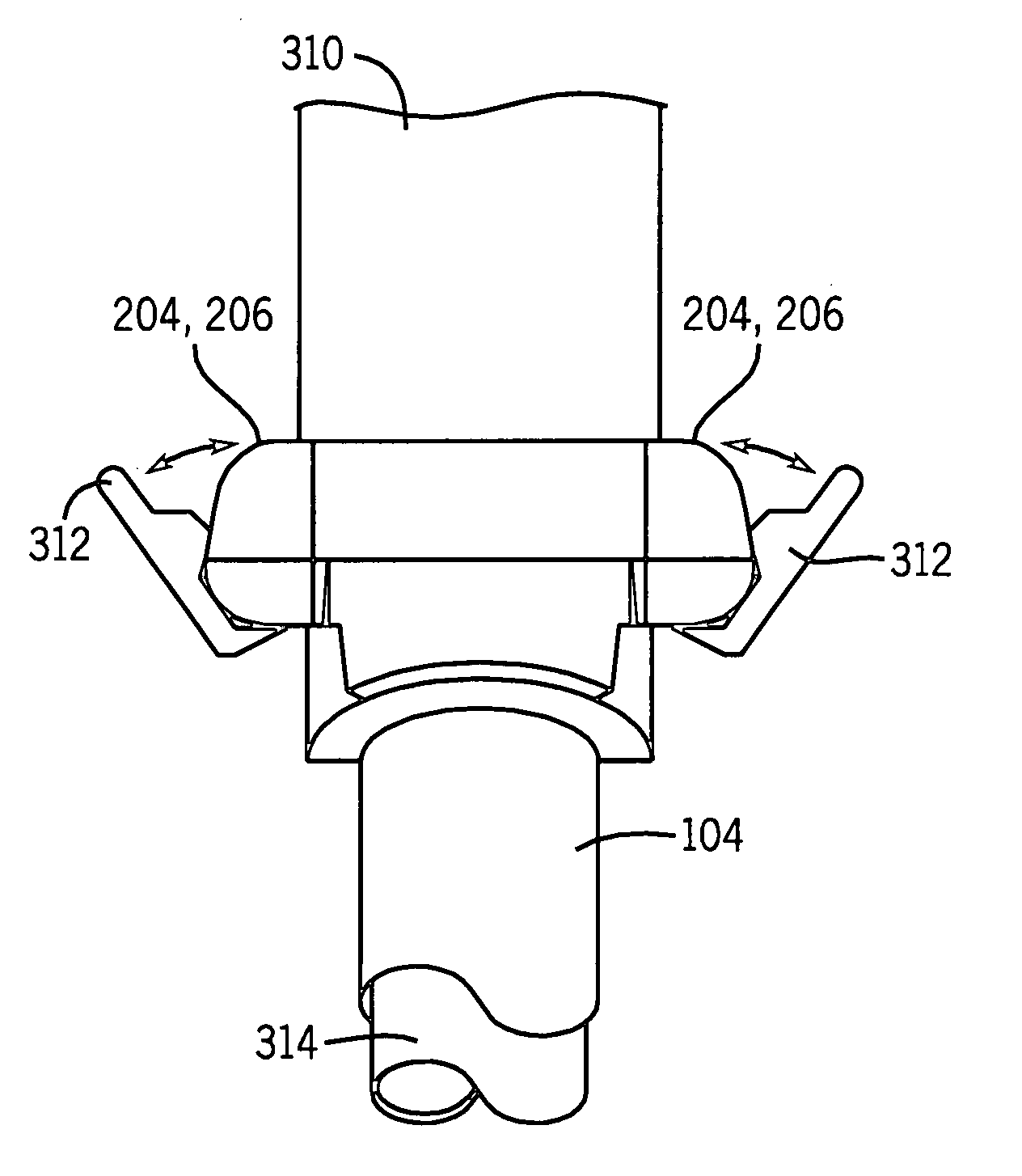 Tracheostomy tube connector key system