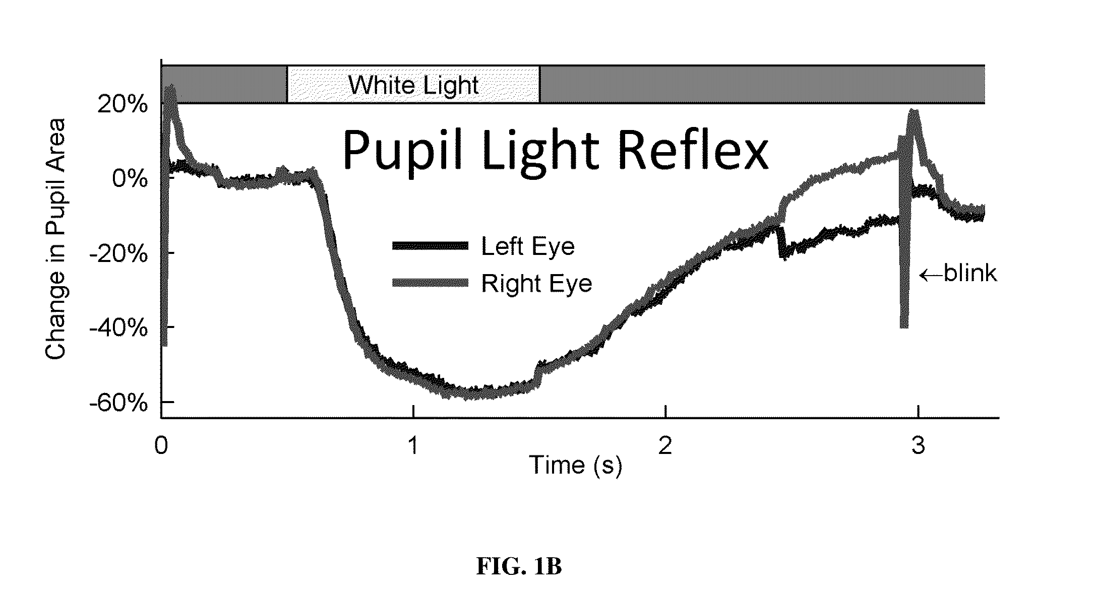 System for traumatic brain injury detection using oculomotor tests