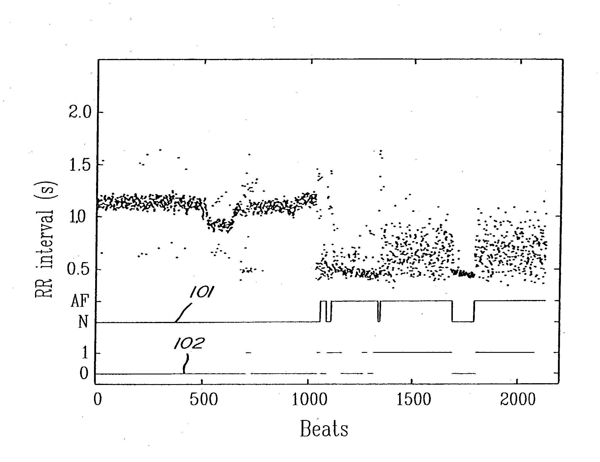 Detection of cardiac arrhythmia using mathematical representation of standard deltaRR probability density histograms