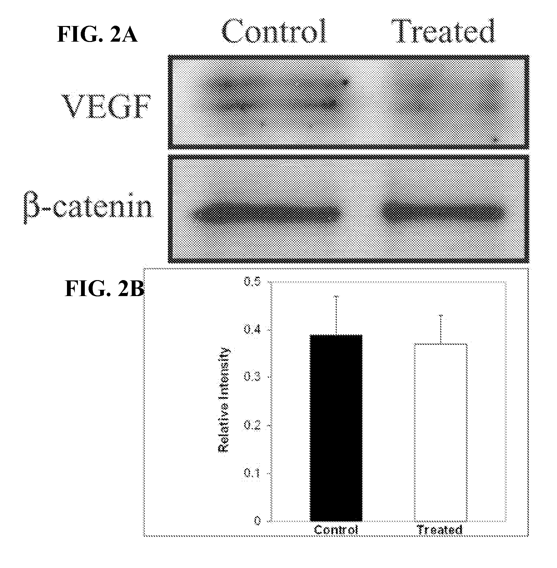 Method of using calcitriol for treating intraocular diseases associated with angiogenesis